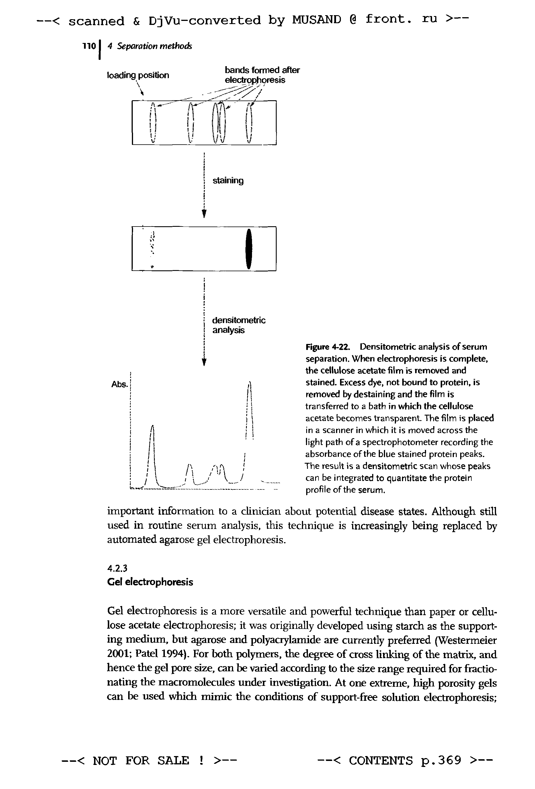 Figure 4-22. Densitometric analysis of serum separation. When electrophoresis is complete, the cellulose acetate film is removed and stained. Excess dye, not bound to protein, is removed by destaining and the film is transferred to a bath in which the cellulose acetate becomes transparent. The film is placed in a scanner in which it is moved across the light path of a spectrophotometer recording the absorbance of the blue stained protein peaks. The result is a densitometric scan whose peaks can be integrated to quantitate the protein profile of the serum.
