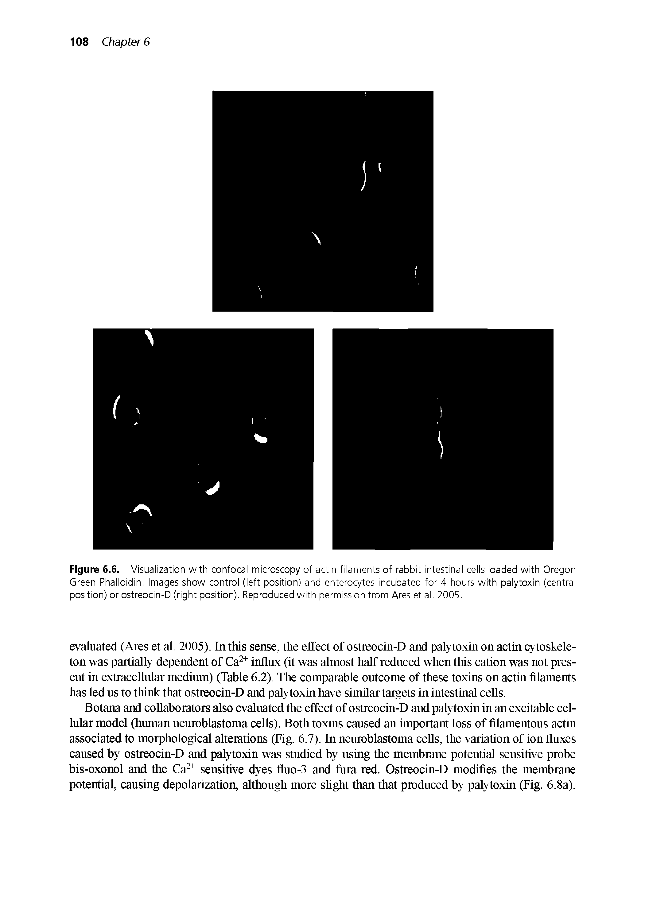 Figure 6.6. Visualization with confocal microscopy of actin filaments of rabbit intestinal cells loaded with Oregon Green Phalloidin. Images show control (left position) and enterocytes incubated for 4 hours with palytoxin (central position) or ostreocin-D (right position). Reproduced with permission from Ares et al. 2005.