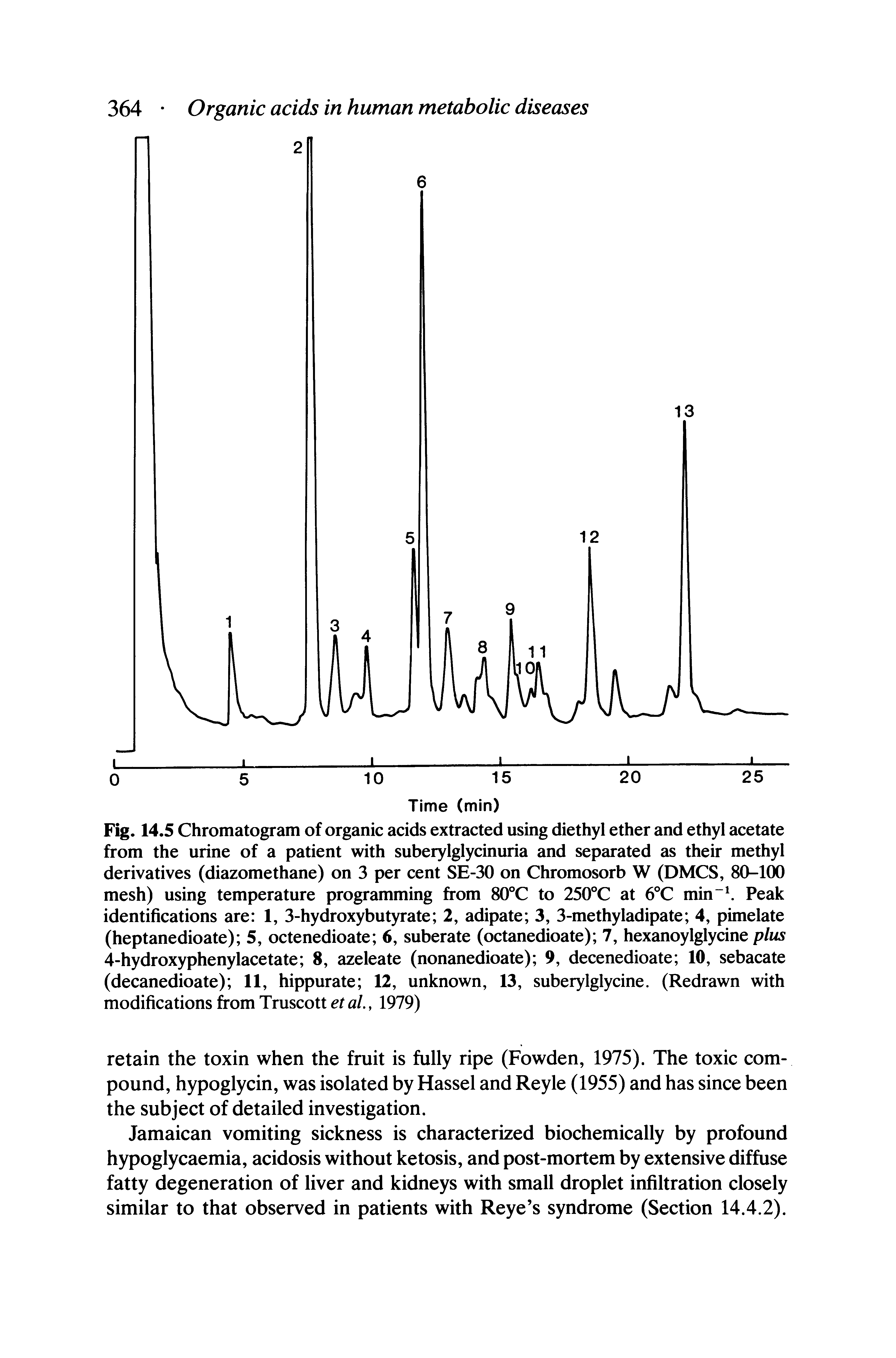 Fig. 14.5 Chromatogram of organic acids extracted using diethyl ether and ethyl acetate from the urine of a patient with suberylglycinuria and separated as their methyl derivatives (diazomethane) on 3 per cent SE-30 on Chromosorb W (DMCS, 80-100 mesh) using temperature programming from 80°C to 250°C at 6°C min Peak identifications are 1, 3-hydroxybutyrate 2, adipate 3, 3-methyladipate 4, pimelate (heptanedioate) 5, octenedioate 6, suberate (octanedioate) 7, hexanoylglycine plus 4-hydroxyphenylacetate 8, azeleate (nonanedioate) 9, decenedioate 10, sebacate (decanedioate) 11, hippurate 12, unknown, 13, suberylglycine. (Redrawn with modifications from Truscott et al., 1979)...
