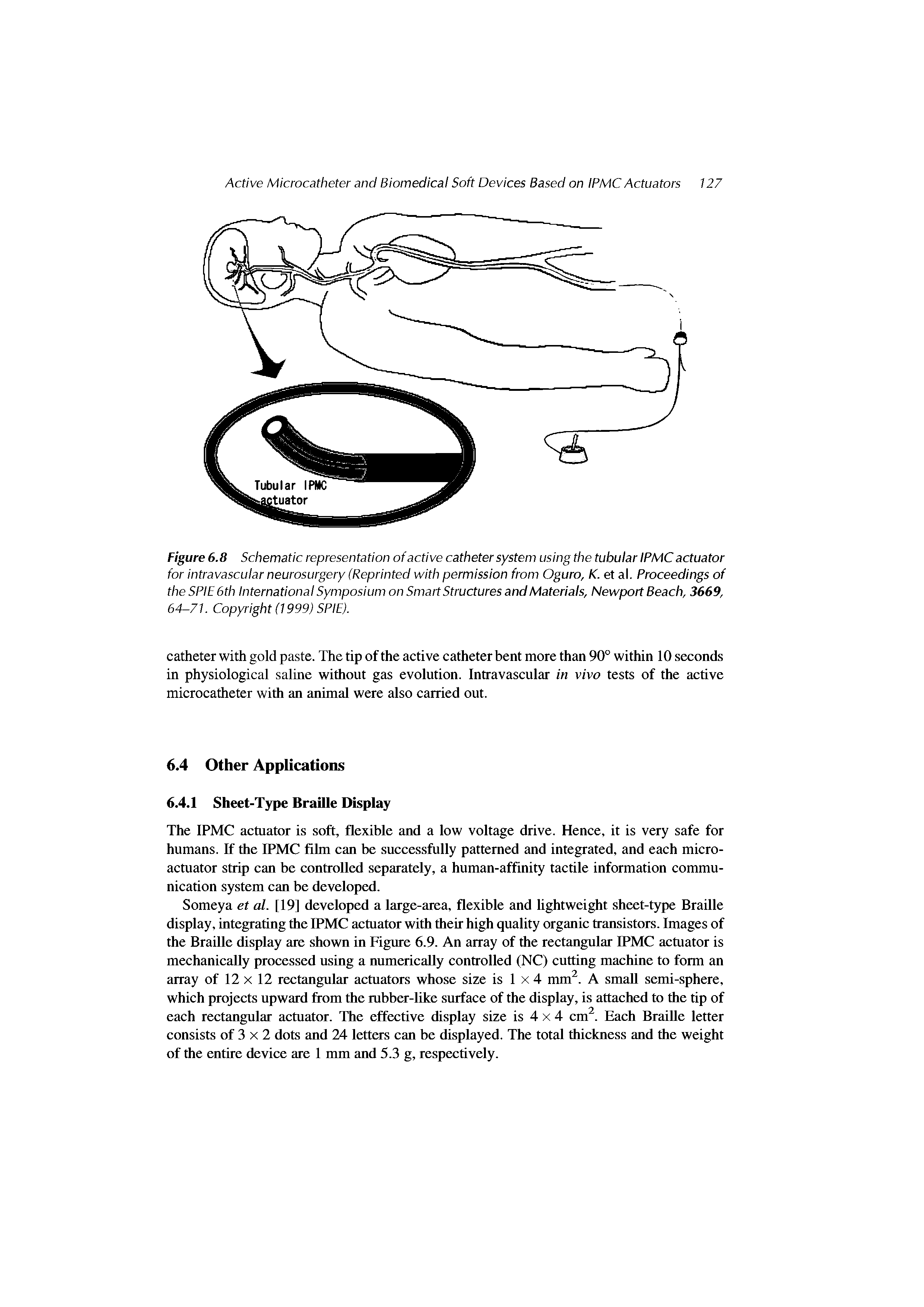 Figure 6.8 Schematic representation of active catheter system using the tubular IPMC actuator for intravascular neurosurgery (Reprinted with permission from Oguro, K. et al. Proceedings of theSPIESth International Symposium on Smart Structures and Materials, Newport Beach, 3669, 64-71. Copyright (1999) SPIE).