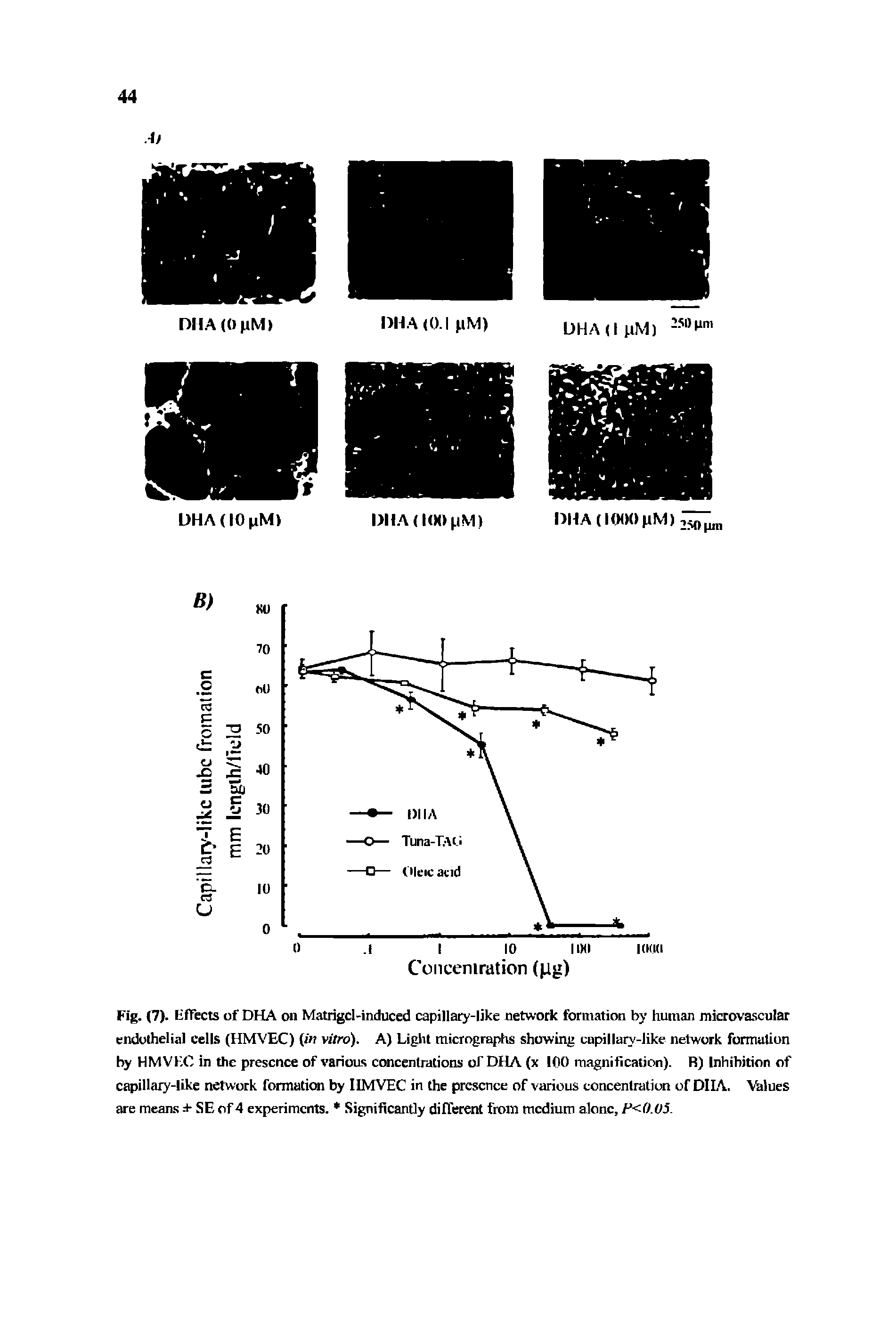 Fig. (7). Effects of DHA on Matrigcl-induced capillary-like network formation by human microvascular endothelial cells (HMVEC) in vitro). A) Light micrographs showing capillary-like network formation by HMVKC in the presence of various concentrations of DHA (x 100 magnification). R) Inhibition of capillary-like network formation by IIMVEC in the presence of various concentration of DI1A. Values are means a- SE of 4 experiments. Significantly different from medium alone, F<0.05.