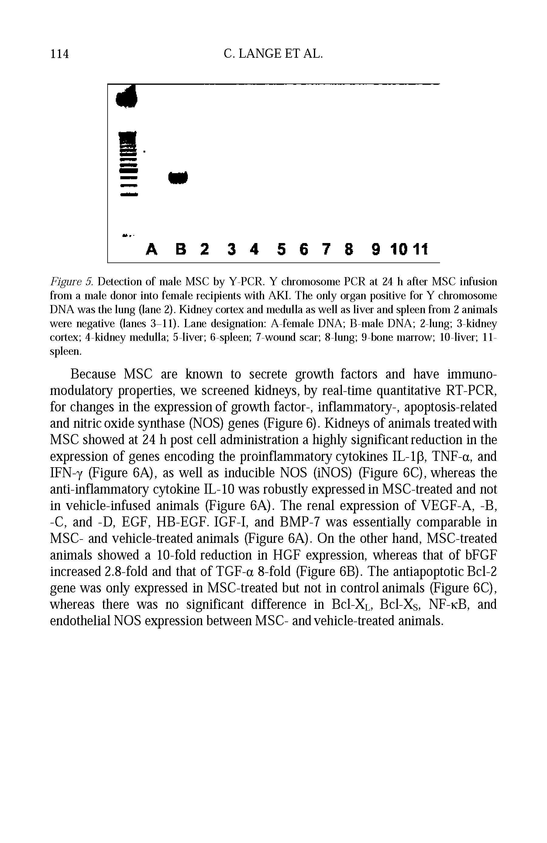 Figure 5. Detection of male MSC by Y-PCR. Y chromosome PCR at 24 h after MSC infusion from a male donor into female recipients with AKl. The only organ positive for Y chromosome DNA was the lung (lane 2). Kidney cortex and medulla as well as liver and spleen from 2 animals were negative (lanes 3-11). Lane designation A-female DNA B-male DNA 2 lung 3-kidney cortex 4-kidney medulla 5-liver 6-spleen 7-wound scar 8-lung 9-bone marrow 10-liver 11-spleen.