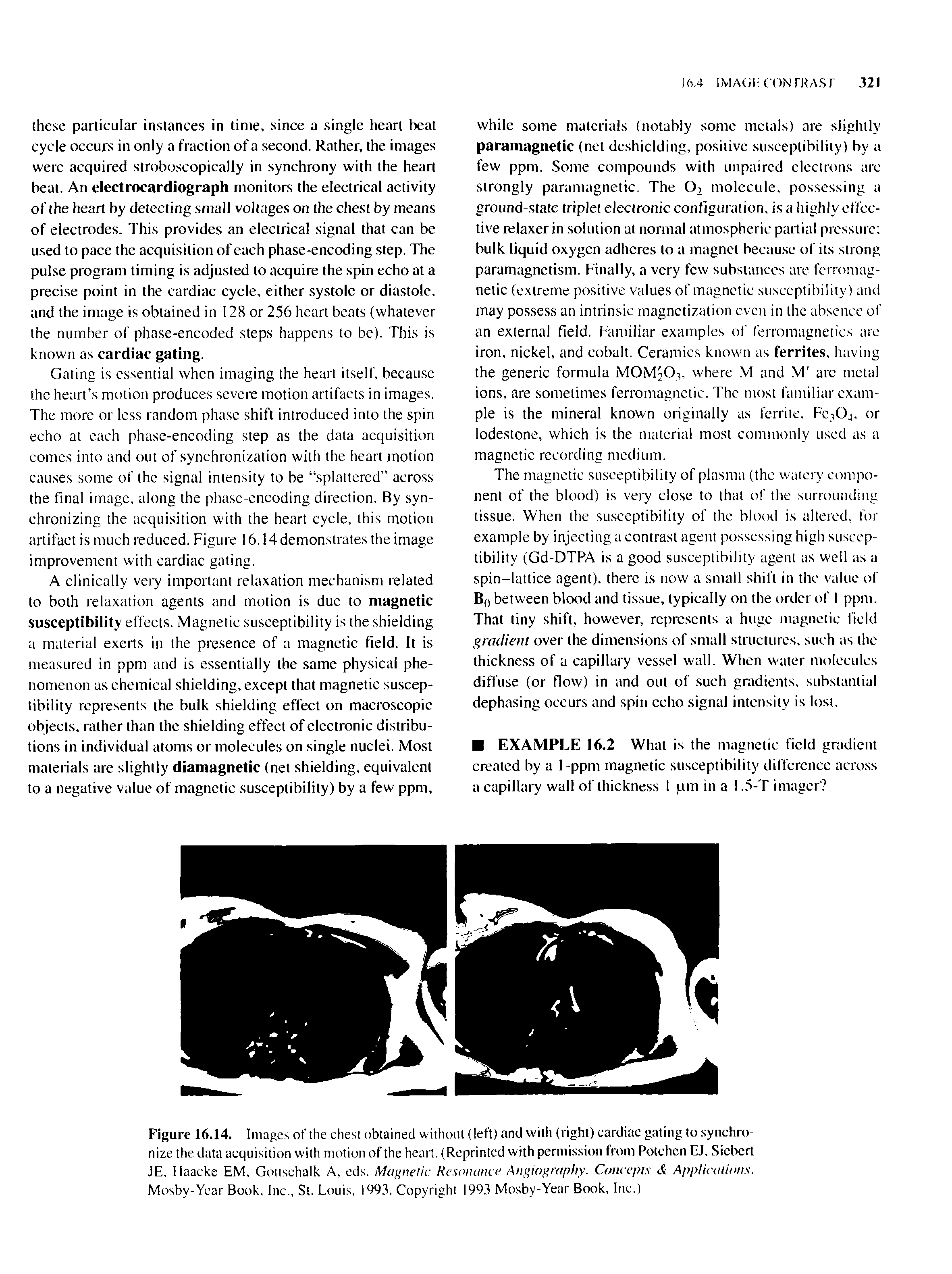 Figure 16,14. Images of the chest obtained without (left) and with (right) cardiac gating to synchronize the data acquisition with motion of the heart. (Reprinted with permission from Potchen EJ. Sicbert JE, Haacke EM, Gottschalk A, eds. Magnetic Resonance Angiography. Concepts Applications. Mosby-Ycar Book, Inc., St. Louis, 1993. Copyright 1993 Mosby-Year Book, Inc.)...