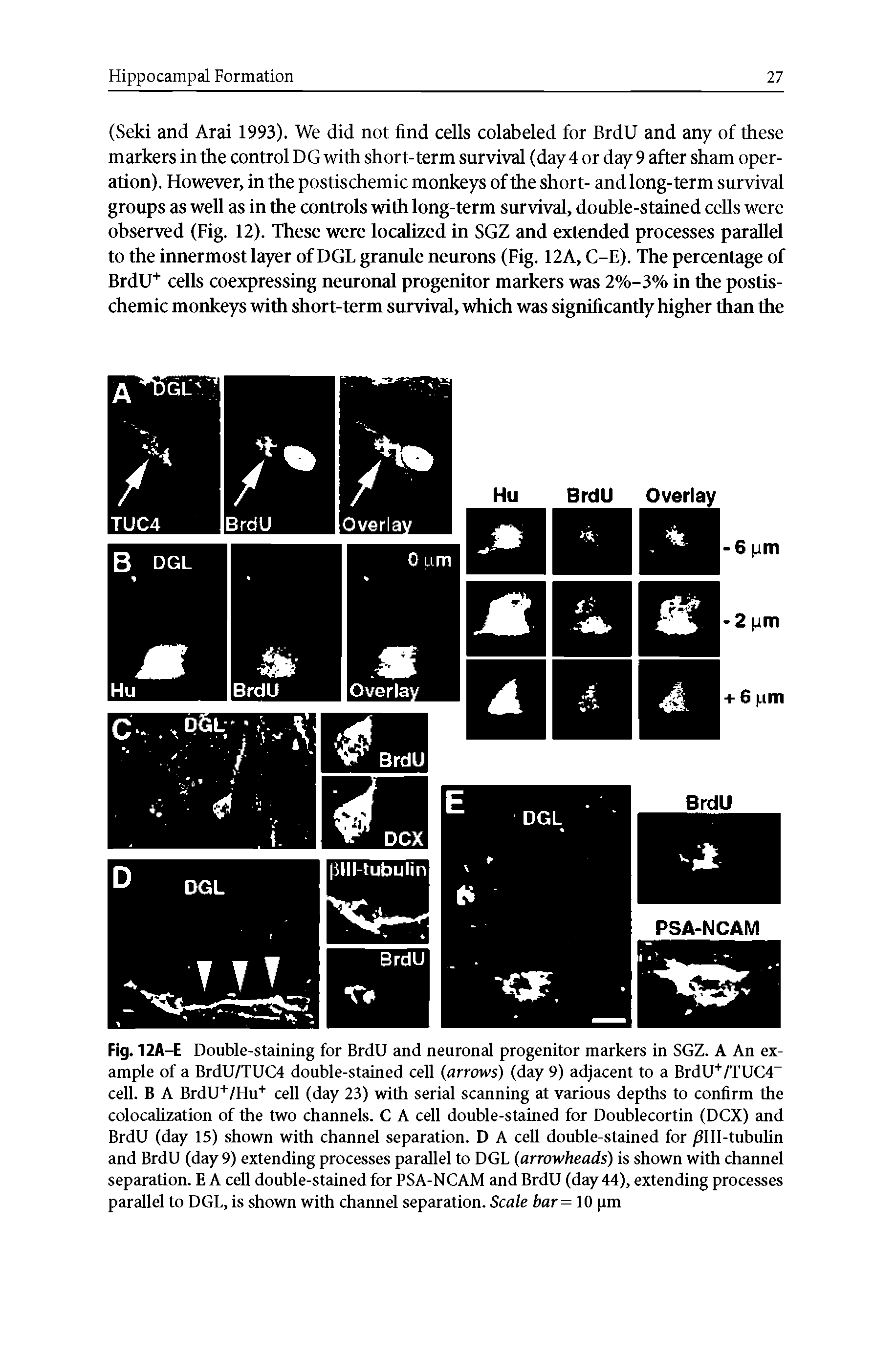 Fig. 12A-E Double-staining for BrdU and neuronal progenitor markers in SGZ. A An example of a BrdU/TUC4 double-stained cell (arrows) (day 9) adjacent to a BrdU+/TUC4 cell. B A BrdU+/Hu+ cell (day 23) with serial scanning at various depths to confirm the colocalization of the two channels. C A cell double-stained for Doublecortin (DCX) and BrdU (day 15) shown with channel separation. D A cell double-stained for /fill-tubulin and BrdU (day 9) extending processes parallel to DGL (arrowheads) is shown with channel separation. E A cell double-stained for PSA-NCAM and BrdU (day 44), extending processes parallel to DGL, is shown with channel separation. Scale bar= 10 pm...