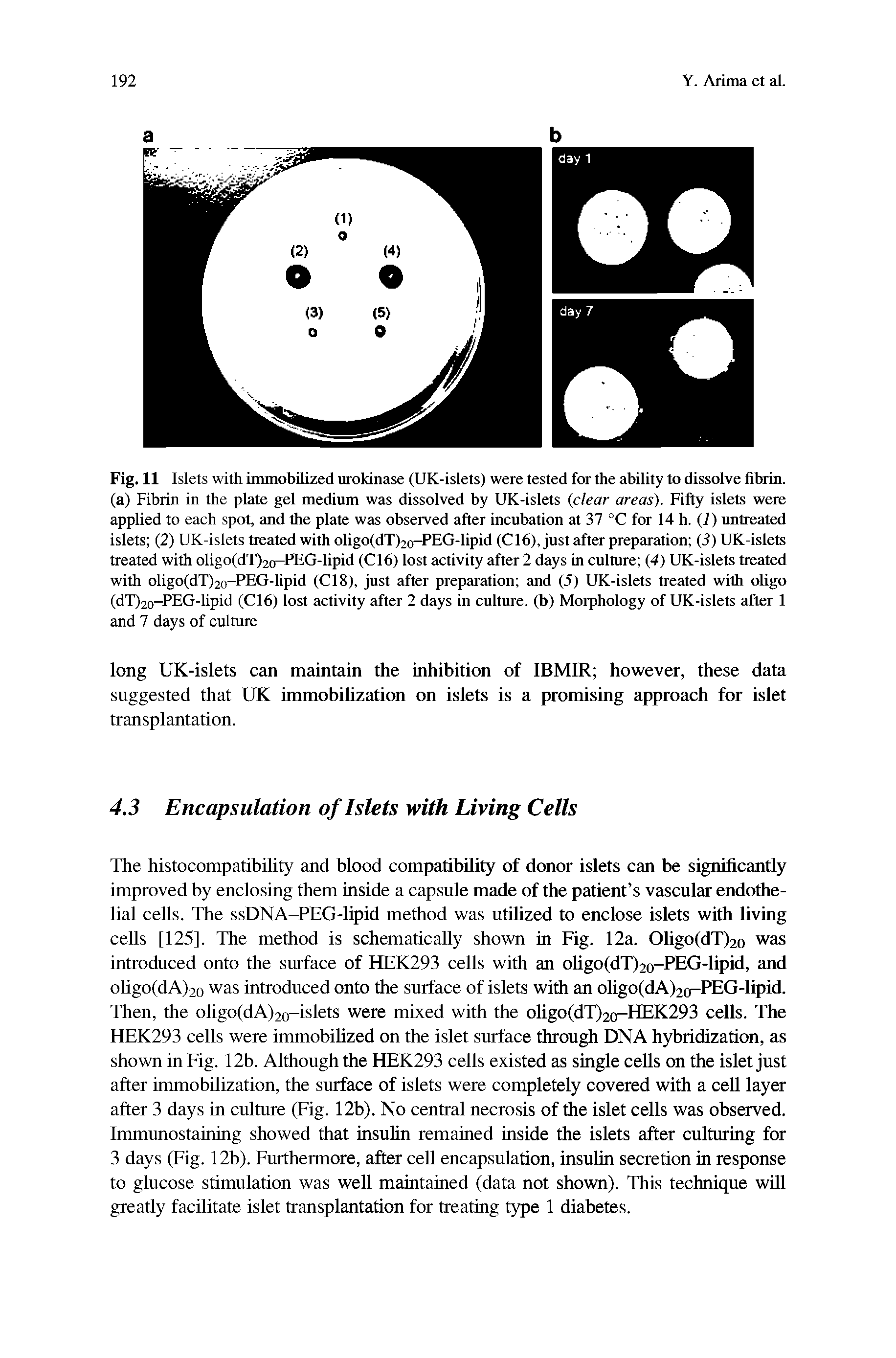 Fig. 11 Islets with immobilized urokinase (UK-islets) were tested for the ability to dissolve fibrin, (a) Fibrin in the plate gel medium was dissolved by UK-islets (clear areas). Fifty islets were applied to each spot, and the plate was observed after incubation at 37 °C for 14 h. (1) untreated islets (2) UK-islets treated with oligo(dT)2o-PEG-lipid (C16), just after preparation (3) UK-islets treated with oligo(dT)2o-PEG-lipid (C16) lost activity after 2 days in culture (4) UK-islets treated with oligo(dT)20-PEG-lipid (C18), just after preparation and (5) UK-islets treated with oligo (dT)20-PEG-lipid (C16) lost activity after 2 days in culture, (b) Morphology of UK-islets after 1 and 7 days of culture...