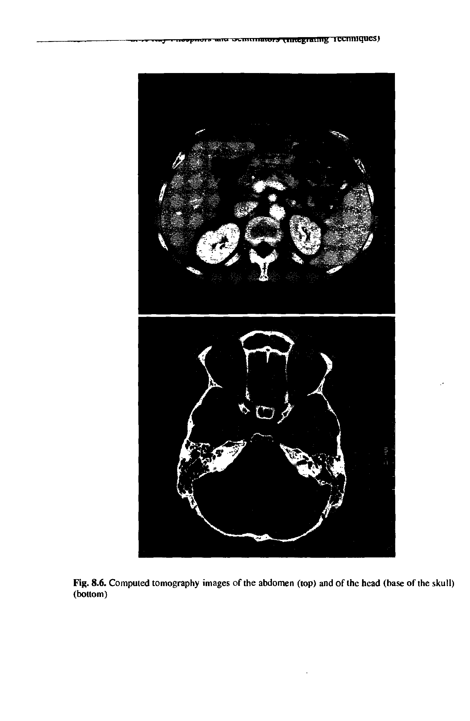 Fig. 8.6. Computed tomography images of the abdomen (top) and of the head (base of the skull) (bottom)...