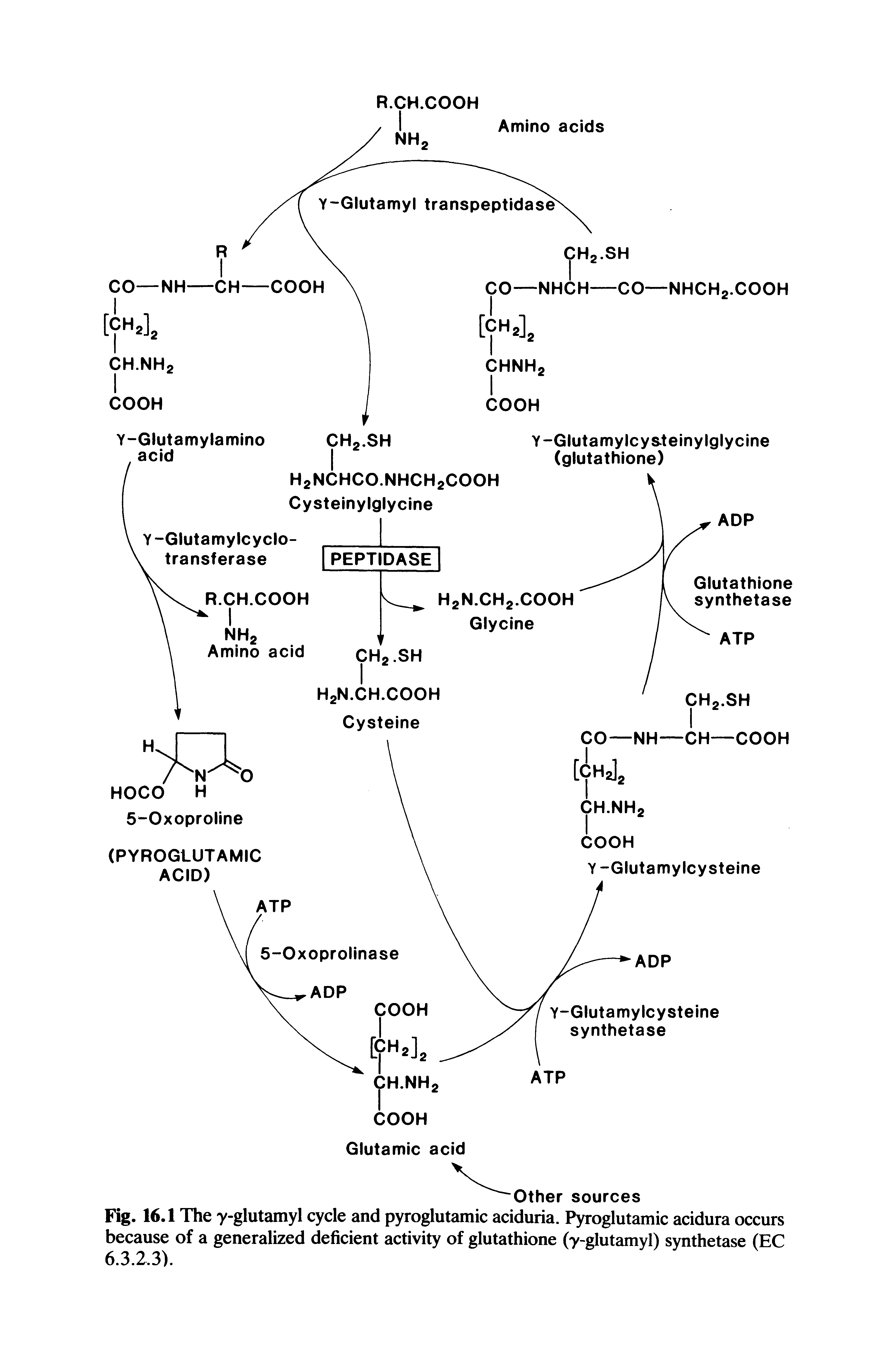 Fig. 16.1 The y-glutamyl cycle and pyroglutamic aciduria. Pyroglutamic acidura occurs because of a generalized deficient activity of glutathione (y-glutamyl) synthetase (EC 6.323).