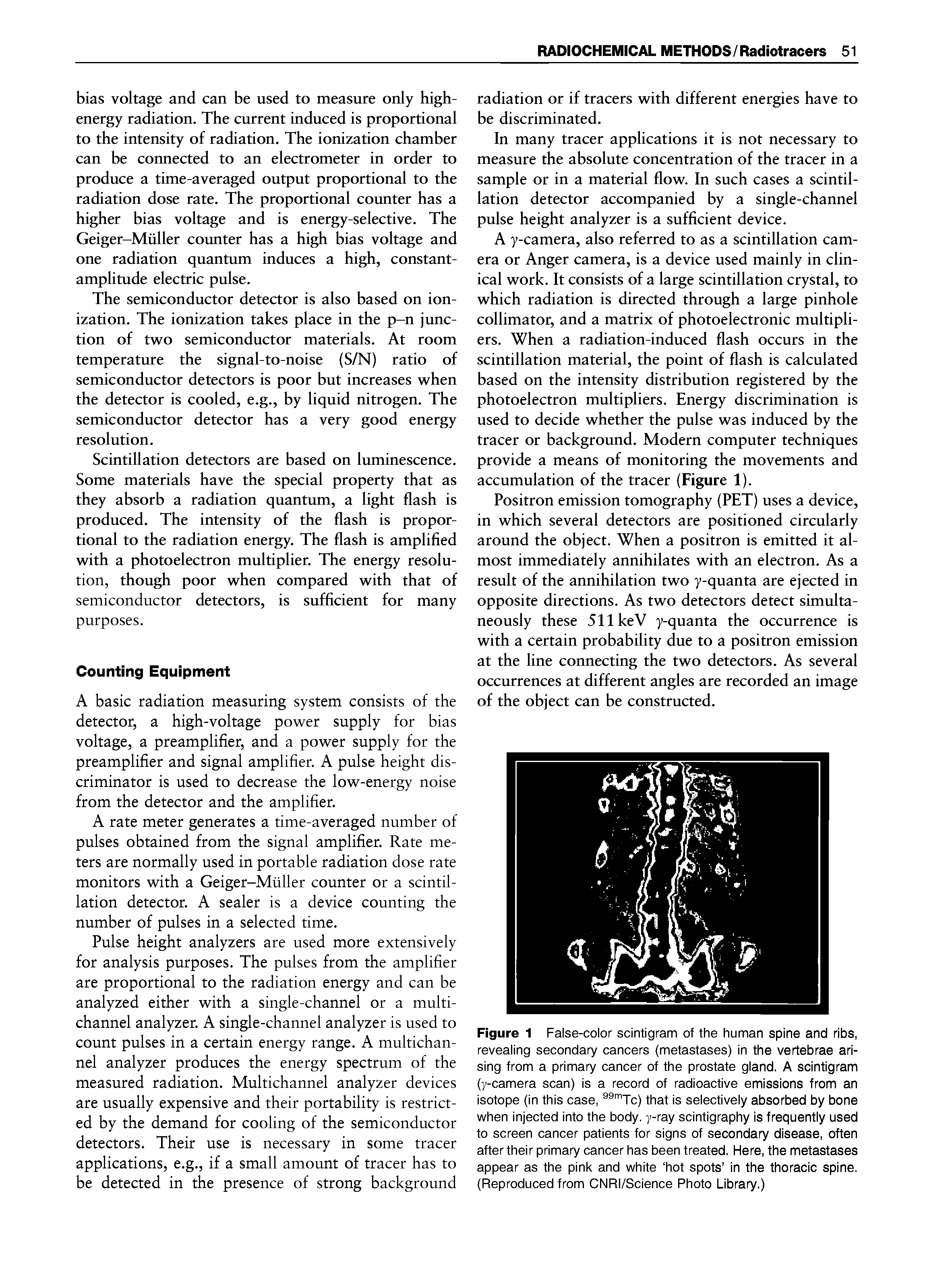Figure 1 False-color scintigram of the human spine and ribs, revealing secondary cancers (metastases) in the vertebrae arising from a primary cancer of the prostate gland. A scintigram (y-camera scan) is a record of radioactive emissions from an isotope (in this case, " Tc) that is selectively absorbed by bone when injected into the body, y-ray scintigraphy is frequently used to screen cancer patients for signs of secondary disease, often after their primary cancer has been treated. Here, the metastases appear as the pink and white hot spots in the thoracic spine. (Reproduced from CNRI/Science Photo Library.)...