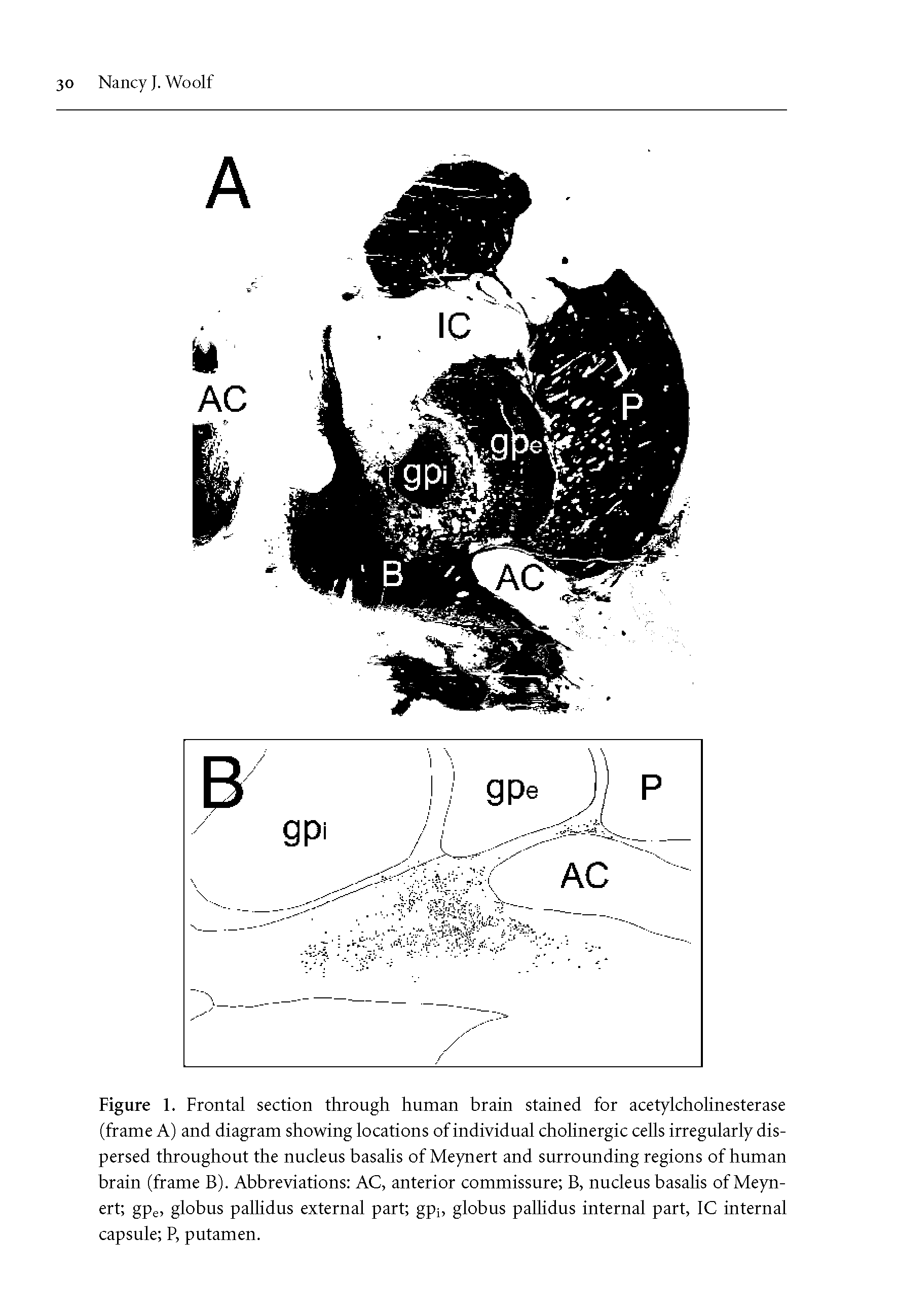 Figure 1. Frontal section through human brain stained for acetylcholinesterase (frame A) and diagram showing locations of individual cholinergic cells irregularly dispersed throughout the nucleus basalis of Meynert and surrounding regions of human brain (frame B). Abbreviations AC, anterior commissure B, nucleus basalis of Meynert gpe, globus pallidus external part gpi, globus pallidus internal part, 1C internal capsule P, putamen.