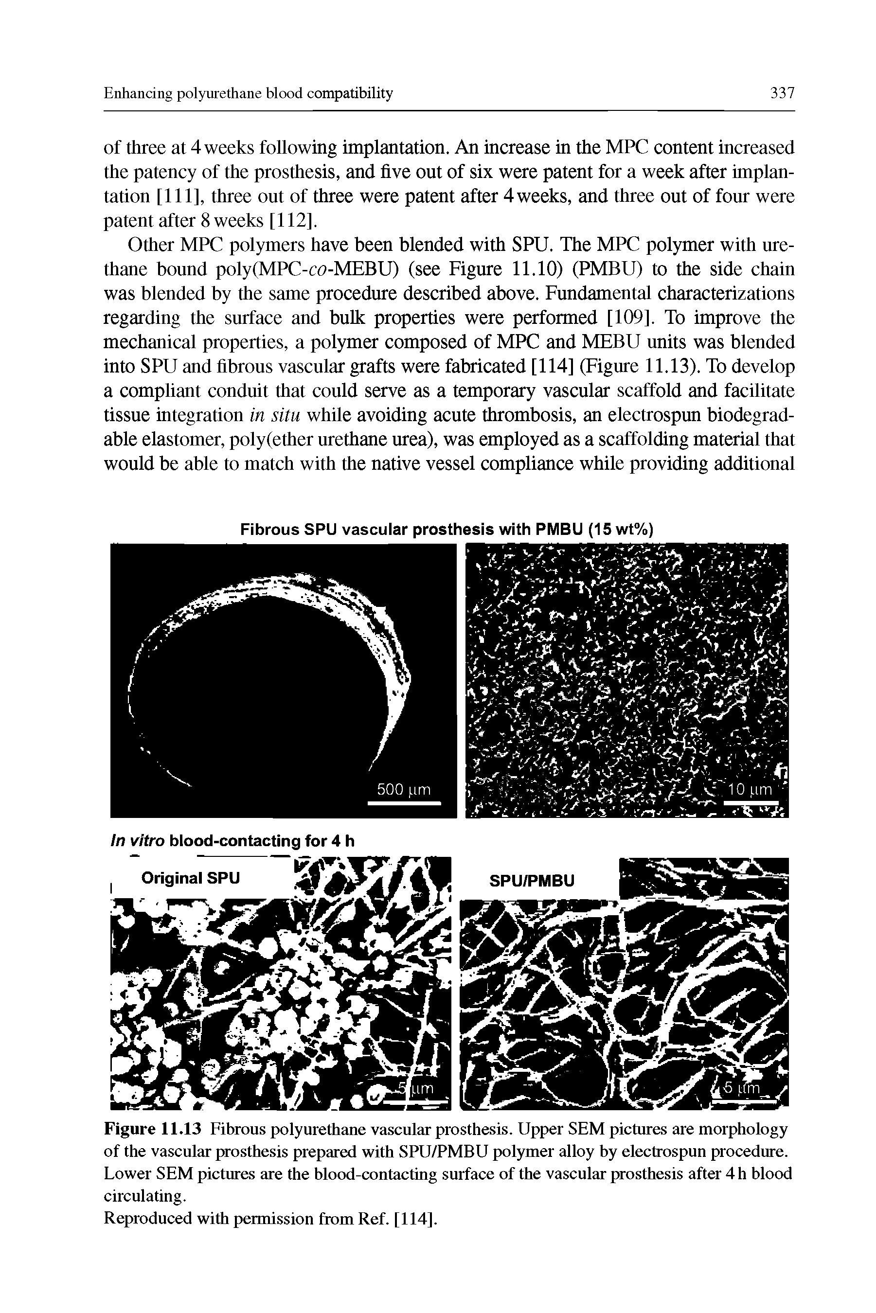 Figure 11.13 Fibrous polyurethane vascular prosthesis. Upper SEM pictures are morphology of the vascular prosthesis prepared with SPU/PMBU polymer alloy by electrospun procedure. Lower SEM pictures are the blood-contacting surface of the vascular prosthesis after 4 h blood circulating.