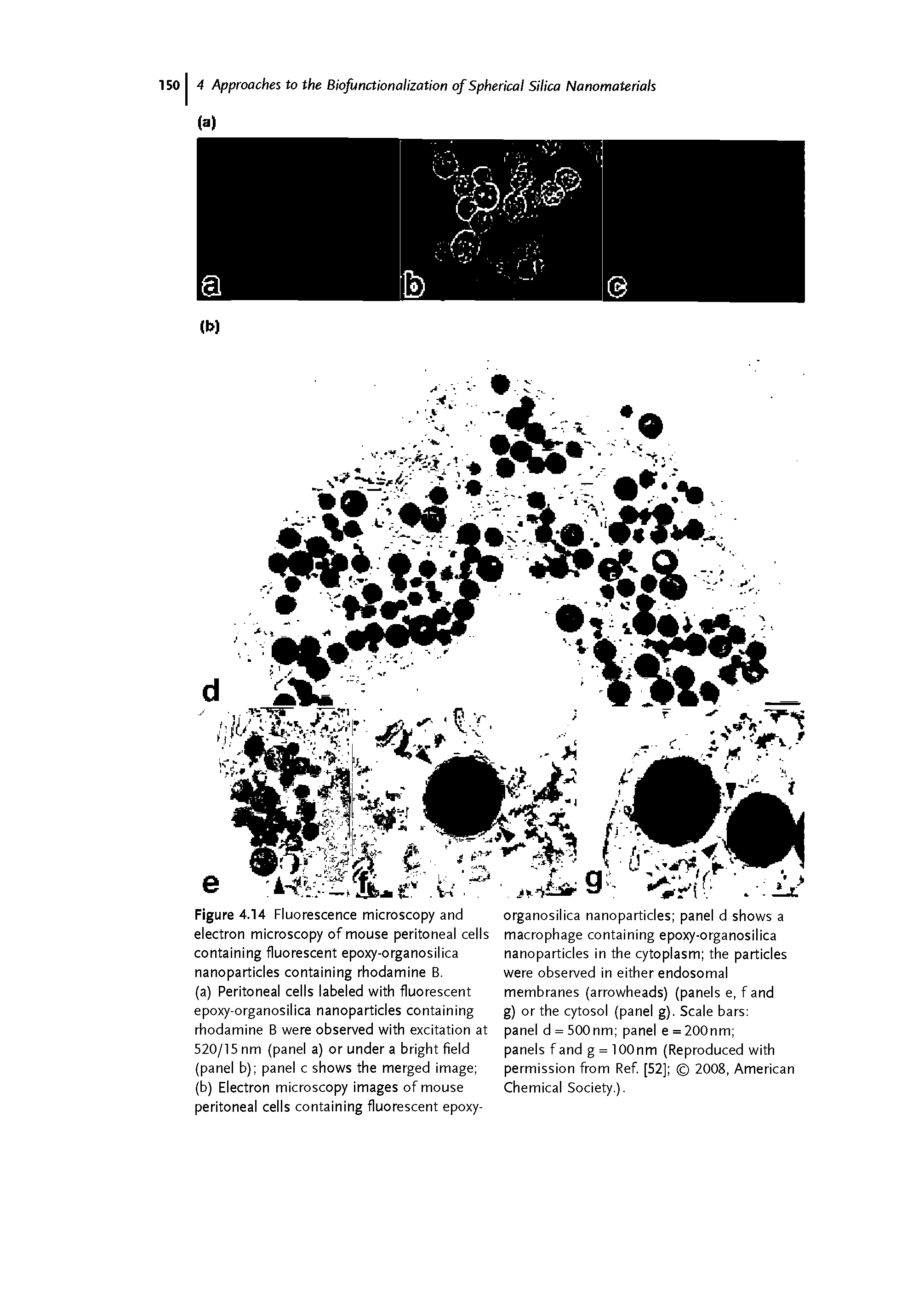Figure 4.14 Fluorescence microscopy and electron microscopy of mouse peritoneal cells containing fluorescent epoxy-organosilica nanoparticles containing rhodamine B.