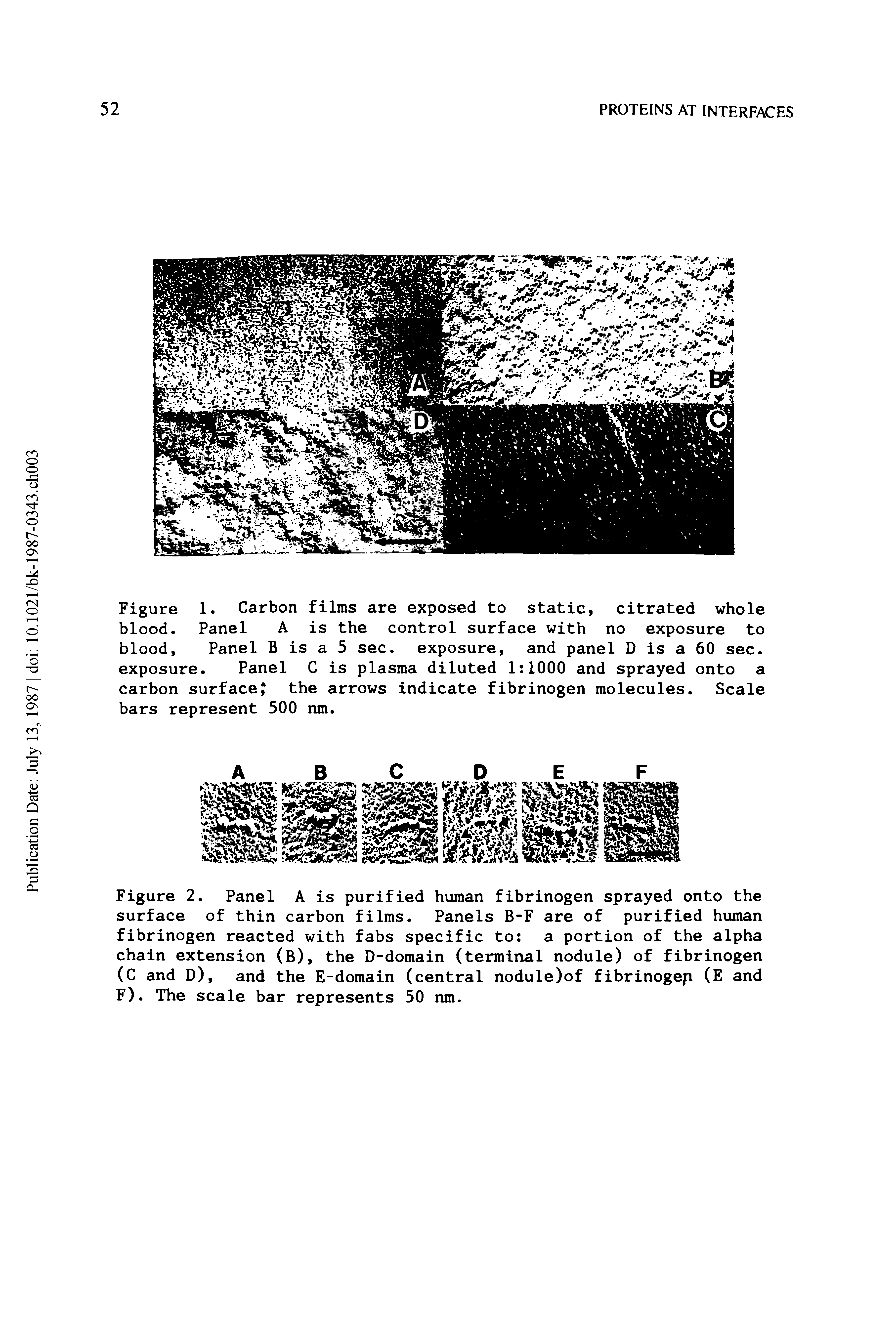 Figure 2. Panel A is purified human fibrinogen sprayed onto the surface of thin carbon films. Panels B-F are of purified human fibrinogen reacted with fabs specific to a portion of the alpha chain extension (B), the D-domain (terminal nodule) of fibrinogen (C and D), and the E-domain (central nodule)of fibrinogep (E and F). The scale bar represents 50 nm.