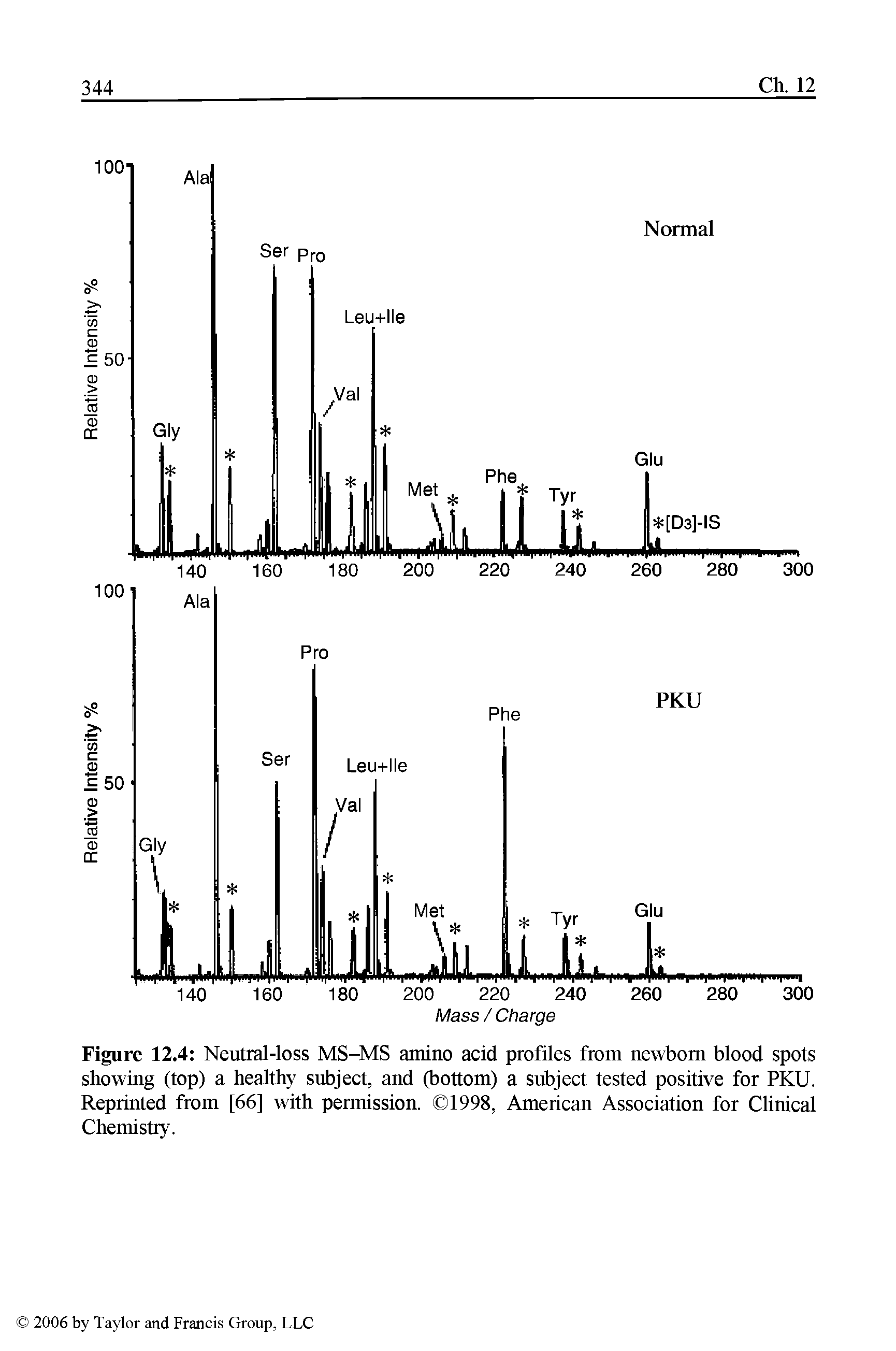 Figure 12.4 Neutral-loss MS-MS amino acid profiles from newborn blood spots showing (top) a healthy subject, and (bottom) a subject tested positive for PKU. Reprinted from [66] with permission. 1998, American Association for Clinical Chemistry.