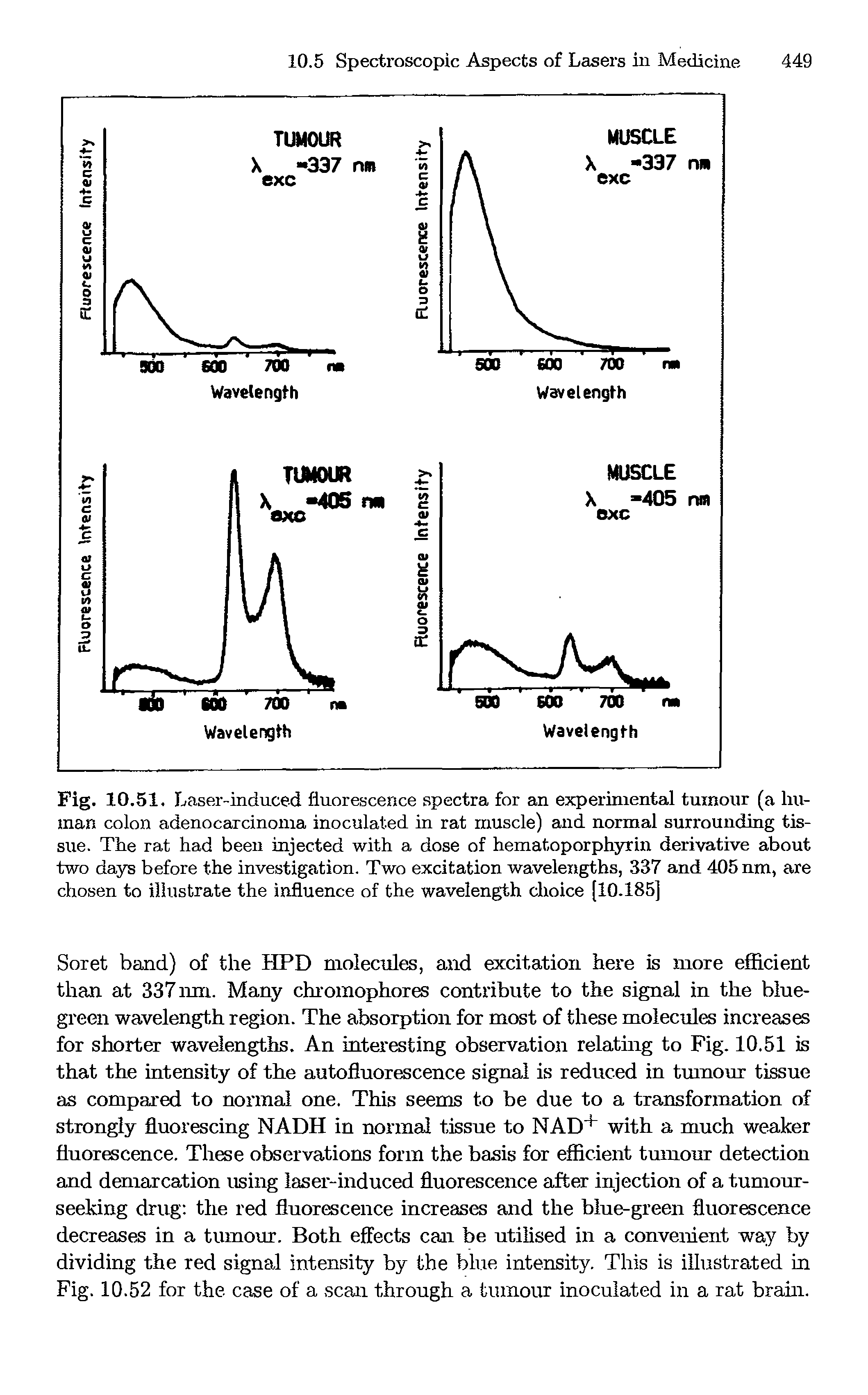 Fig. 10.51. Laser-induced fluorescence spectra for an experimental tumour (a human colon adenocarcinoma inoculated in rat muscle) and normal surrounding tissue. The rat had been injected with a dose of hematoporphyrin derivative about two days before the investigation. Two excitation wavelengths, 337 and 405 nm, are chosen to illustrate the influence of the wavelength choice [10.185]...