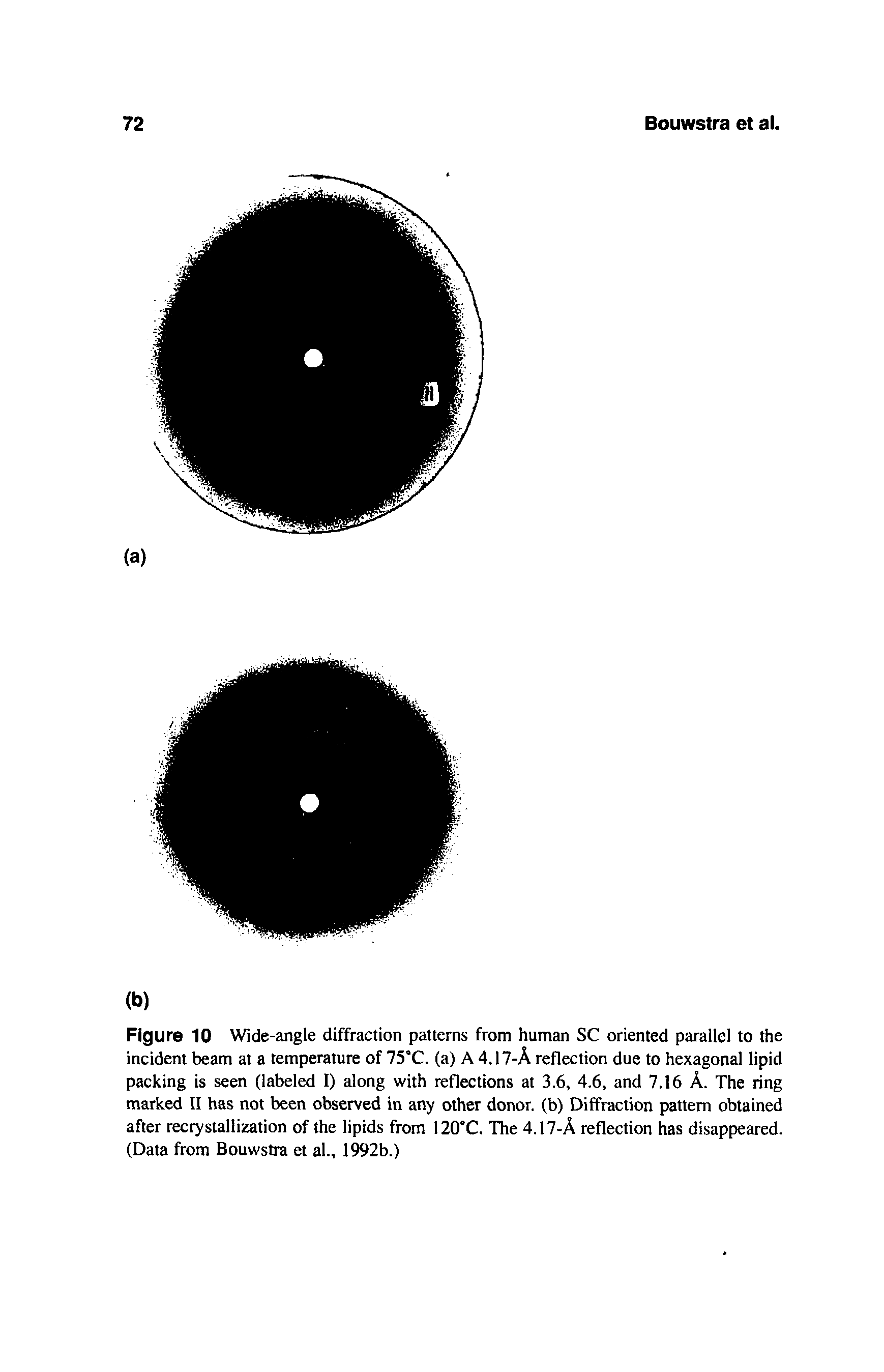 Figure 10 Wide-angle diffraction patterns from human SC oriented parallel to the incident beam at a temperature of 75 C. (a) A 4.17-A reflection due to hexagonal lipid packing is seen (labeled I) along with reflections at 3.6, 4.6, and 7.16 A. The ring marked II has not been observed in any other donor, (b) Diffraction pattern obtained after recrystallization of the lipids from 120°C. The 4.17-A reflection has disappeared. (Data from Bouwstra et al., 1992b.)...