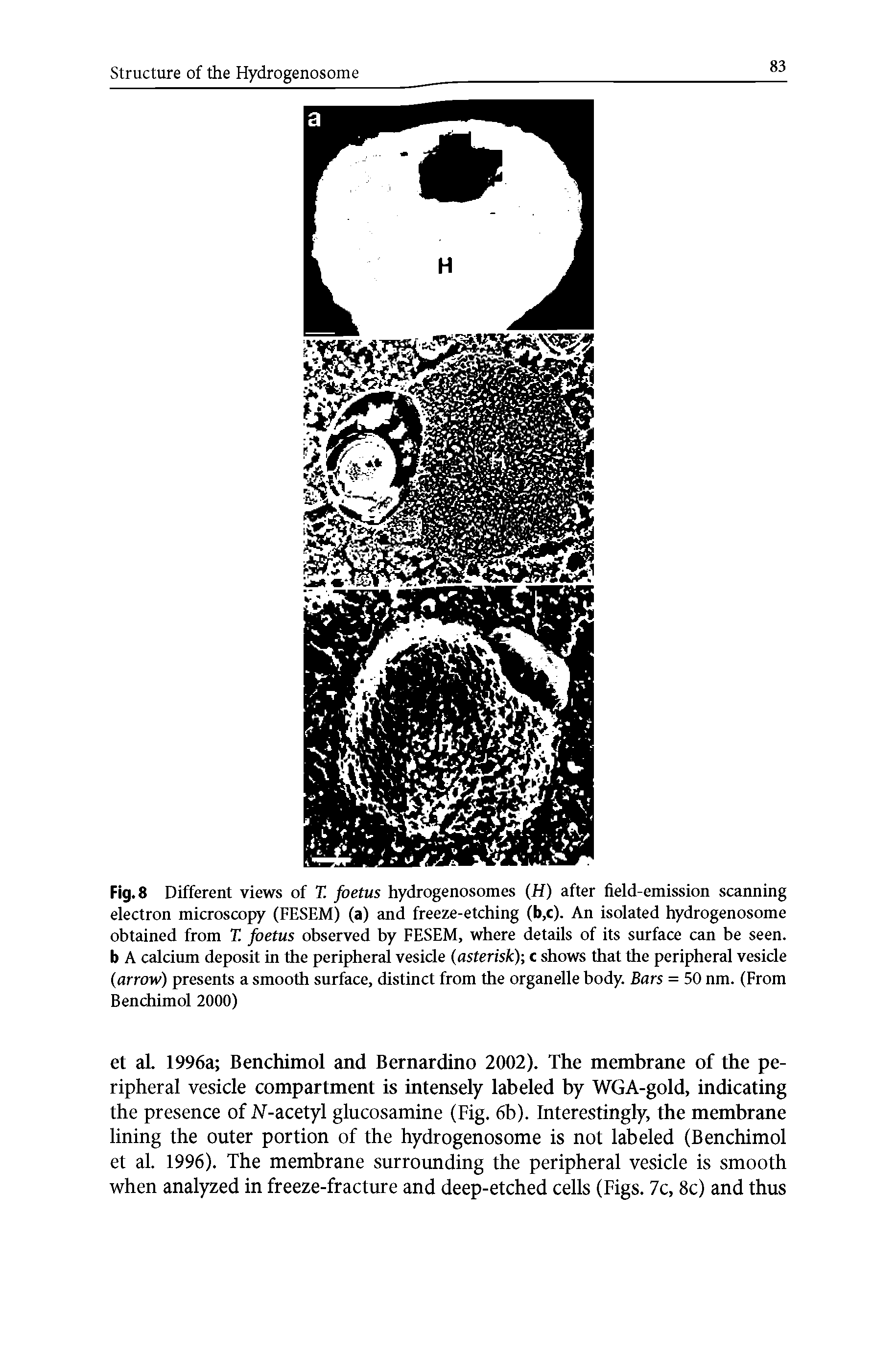 Fig. 8 Different views of T. foetus hydrogenosomes ( ) after field-emission scanning electron microscopy (FESEM) (a) and freeze-etching (b,c). An isolated hydrogenosome obtained from T. foetus observed by FESEM, where details of its surface can be seen, b A calcium deposit in the peripheral vesicle (asterisk) c shows that the peripheral vesicle (arrow) presents a smooth surface, distinct from the organelle body. Bars = 50 nm. (From Benchimol 2000)...