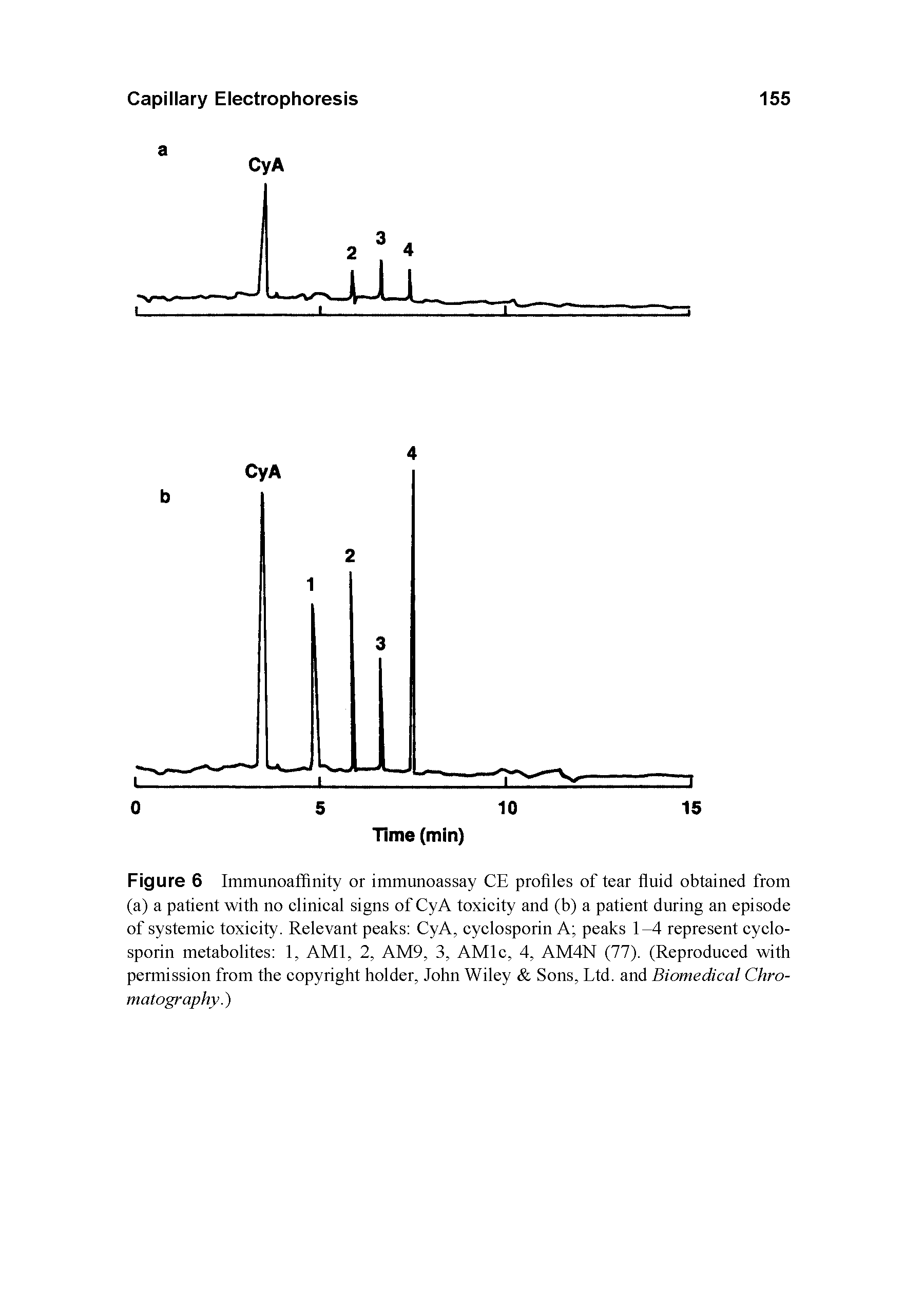 Figure 6 Immunoaffinity or immunoassay CE profiles of tear fluid obtained from (a) a patient with no clinical signs of CyA toxicity and (b) a patient during an episode of systemic toxicity. Relevant peaks CyA, cyclosporin A peaks 1-4 represent cyclosporin metabolites 1, AMI, 2, AM9, 3, AMlc, 4, AM4N (77). (Reproduced with permission from the copyright holder, John Wiley Sons, Ltd. and Biomedical Chromatography.)...