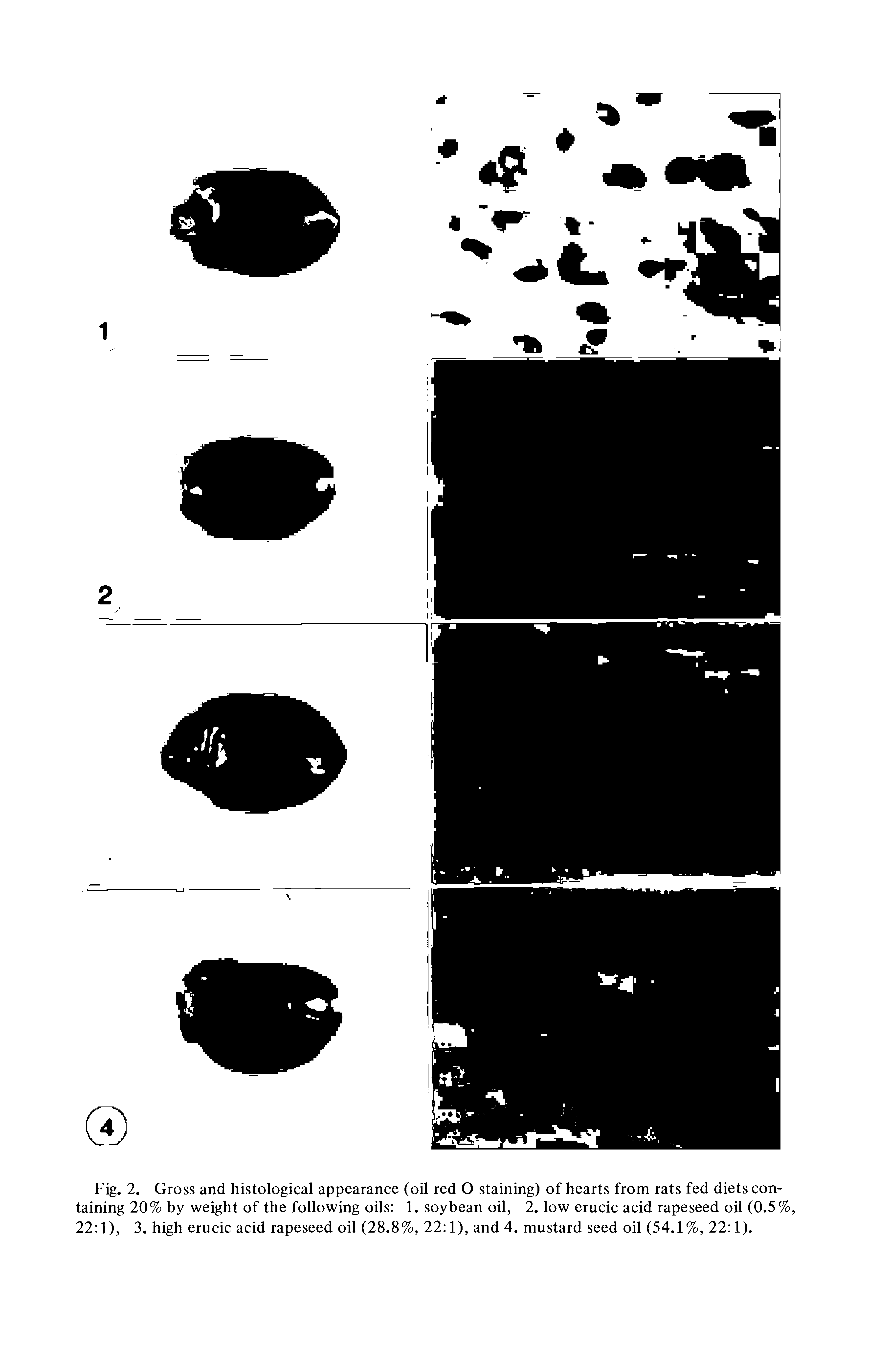 Fig. 2. Gross and histological appearance (oil red O staining) of hearts from rats fed diets containing 20% by weight of the following oils 1. soybean oil, 2. low erucic acid rapeseed oil (0.5% 22 1), 3. high erucic acid rapeseed oil (28.8%, 22 1), and 4. mustard seed oil (54.1%, 22 1).