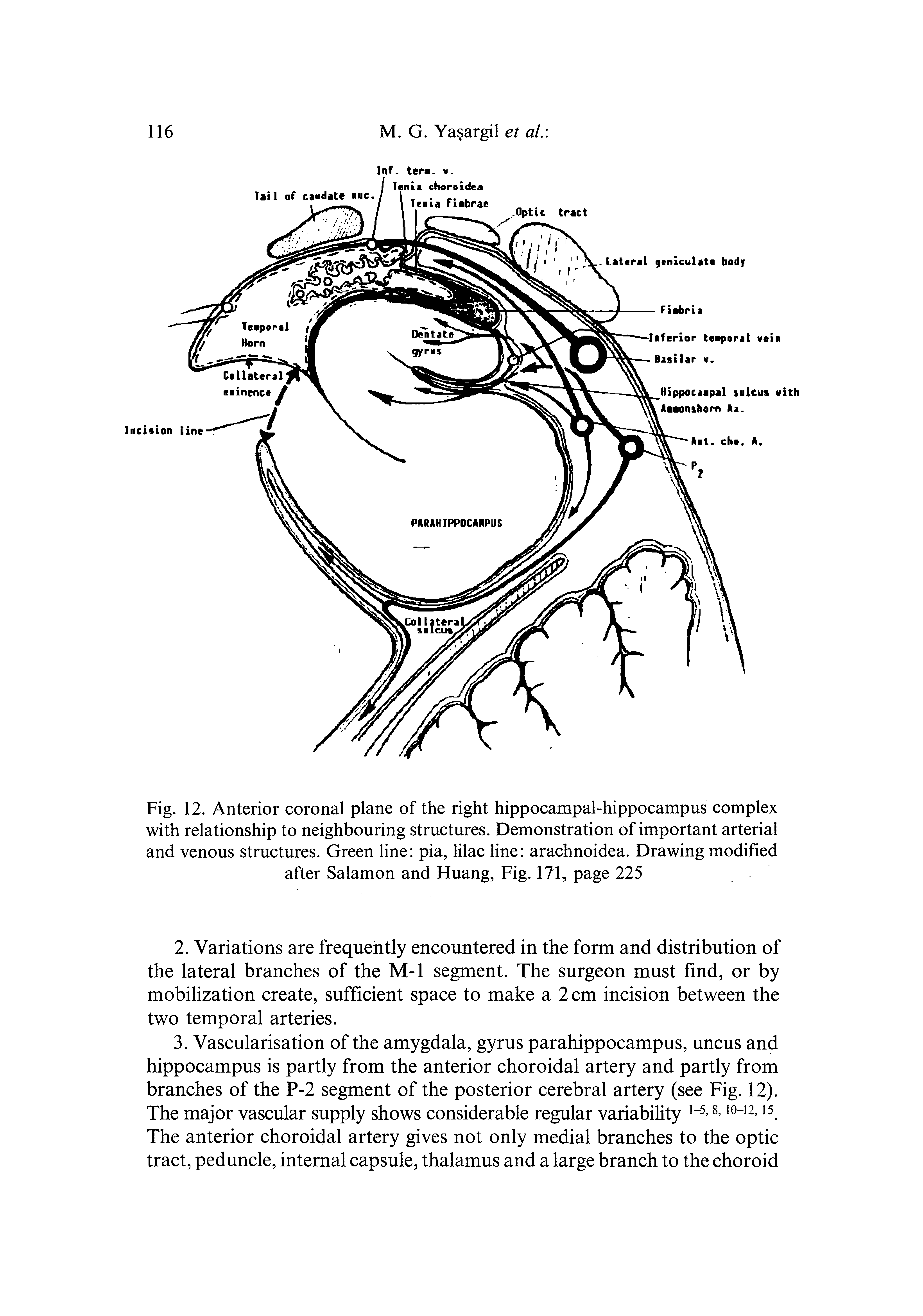 Fig. 12. Anterior coronal plane of the right hippocampal-hippocampus complex with relationship to neighbouring structures. Demonstration of important arterial and venous structures. Green line pia, hlac line arachnoidea. Drawing modified after Salamon and Huang, Fig. 171, page 225...