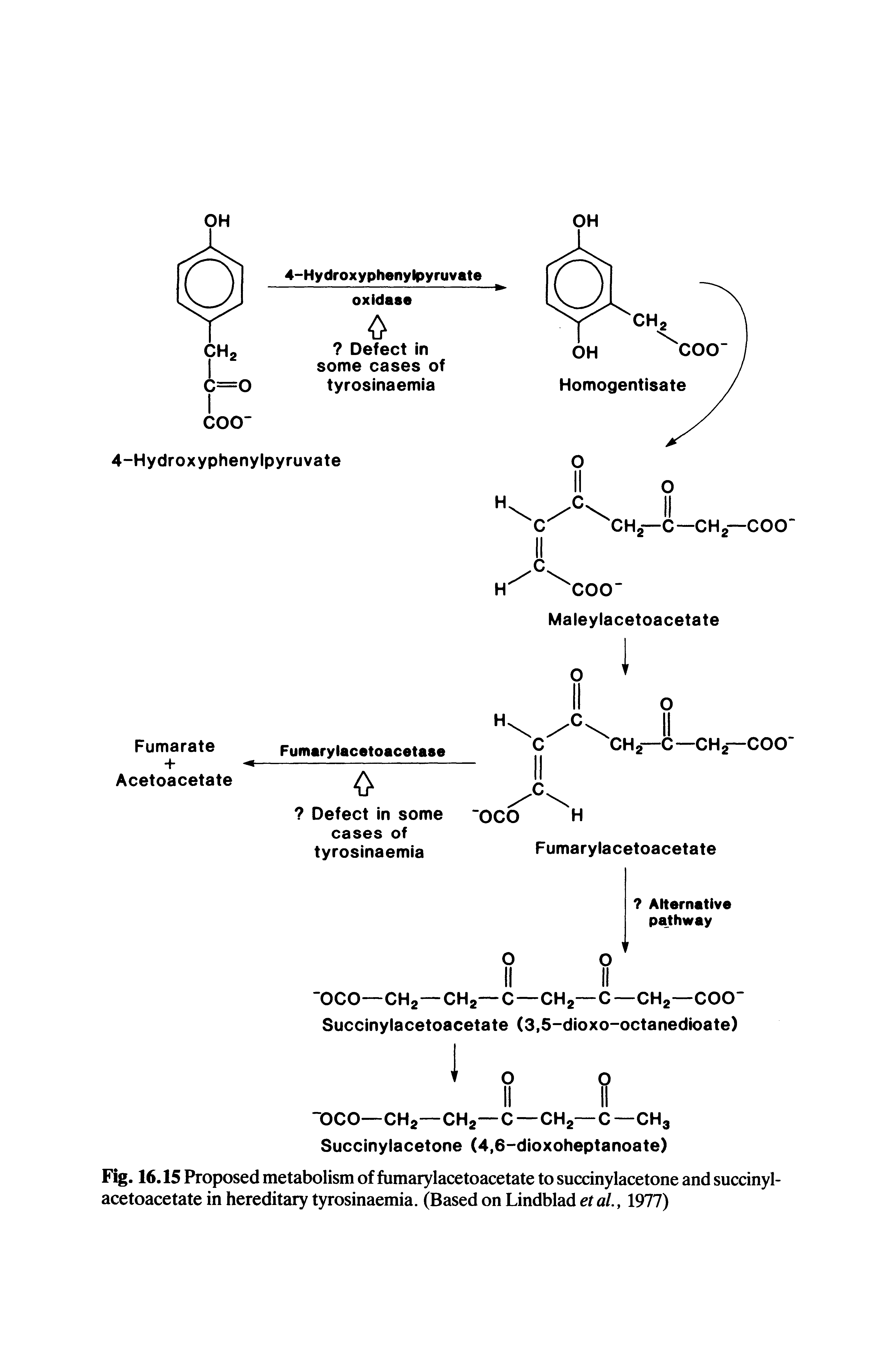 Fig. 16.15 Proposed metabolism of fumarylacetoacetate to succinylacetone and succinylacetoacetate in hereditary tyrosinaemia. (Based on Lindblad etal.y 1977)...