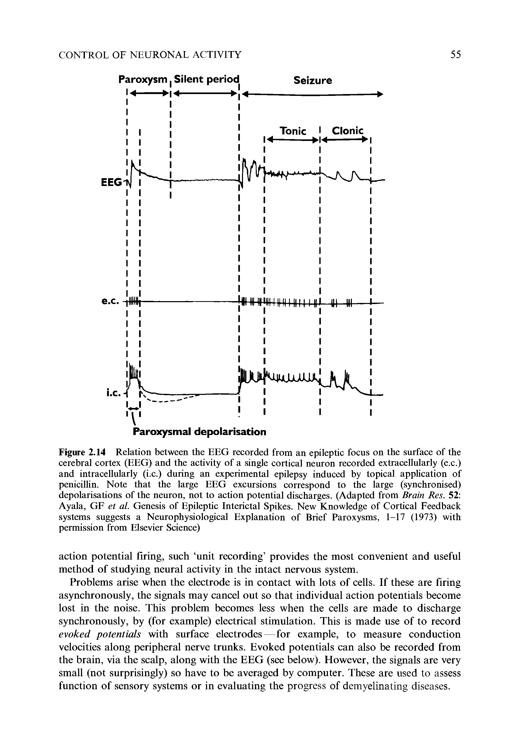 Figure 2.14 Relation between the EEG recorded from an epileptic focus on the surface of the cerebral cortex (EEG) and the activity of a single cortical neuron recorded extracellularly (e.c.) and intracellularly (i.c.) during an experimental epilepsy induced by topical application of penicillin. Note that the large EEG excursions correspond to the large (synchronised) depolarisations of the neuron, not to action potential discharges. (Adapted from Brain Res. 52 Ayala, GF et al. Genesis of Epileptic Interictal Spikes. New Knowledge of Cortical Feedback systems suggests a Neurophysiological Explanation of Brief Paroxysms, 1-17 (1973) with permission from Elsevier Science)...
