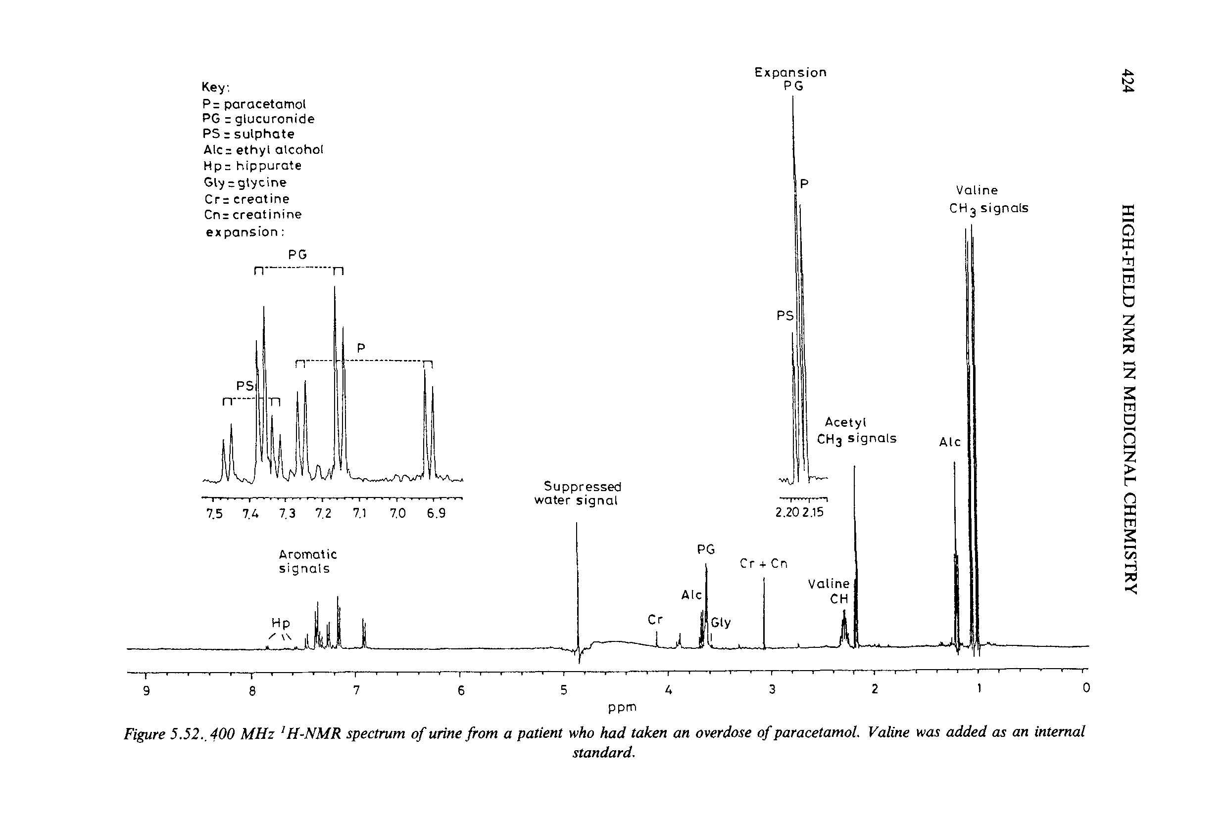 Figure 5.52., 400 MHz H-NMR spectrum of urine from a patient who had taken an overdose of paracetamol. Valine was added as an internal...
