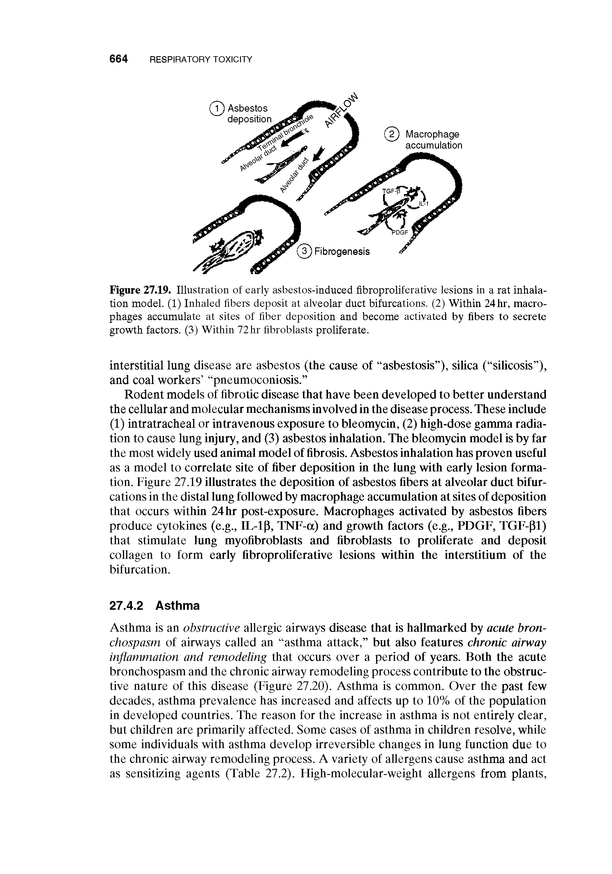 Figure 27.19. Illustration of early asbestos-induced fibroproliferative lesions in a rat inhalation model. (1) Inhaled fibers deposit at alveolar duct bifurcations. (2) Within 24 hr, macrophages accumulate at sites of fiber deposition and become activated by fibers to secrete growth factors. (3) Within 72hr fibroblasts proliferate.