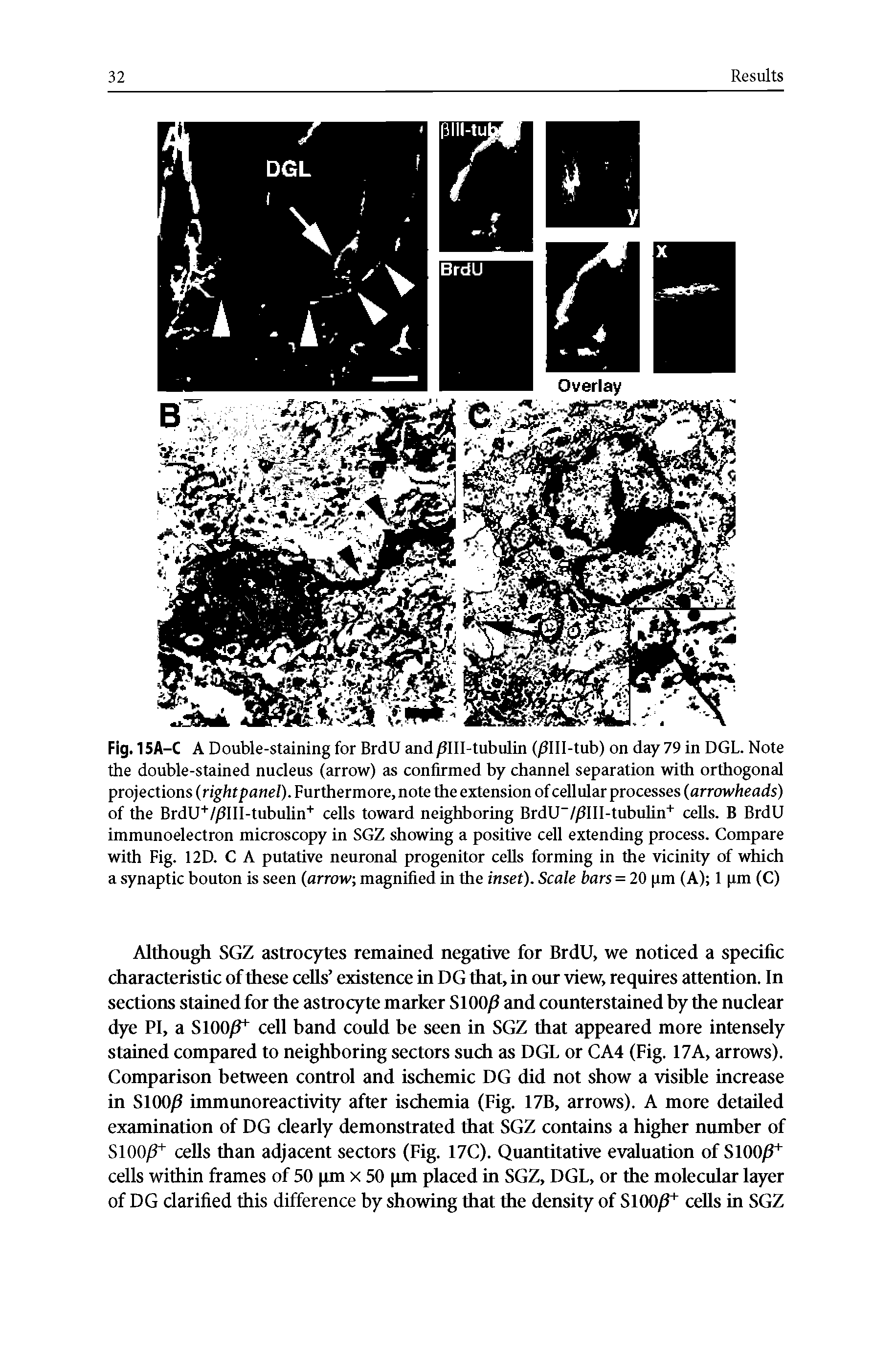 Fig. 15A-C A Double-staining for BrdU and/1111-tubulin (/1111-tub) on day 79 in DGL. Note the double-stained nucleus (arrow) as confirmed by channel separation with orthogonal projections (right panel). Furthermore, note the extension of cellular processes (arrowheads) of the BrdU+//3III-tubulin+ cells toward neighboring BrdU-//3III-tubulin+ cells. B BrdU immunoelectron microscopy in SGZ showing a positive cell extending process. Compare with Fig. 12D. C A putative neuronal progenitor cells forming in the vicinity of which a synaptic bouton is seen (arrow magnified in the inset). Scale bars = 20 pm (A) 1 pm (C)...