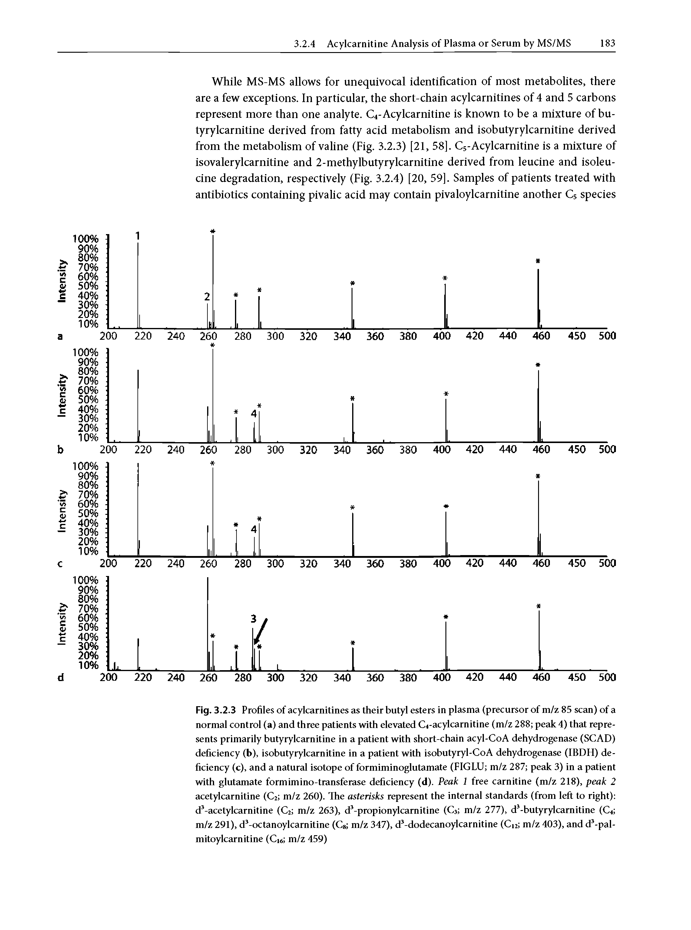 Fig. 3.2.3 Profiles of acylcarnitines as their butyl esters in plasma (precursor of m/z 85 scan) of a normal control (a) and three patients with elevated Gi-acyl carnitine (m/z 288 peak 4) that represents primarily butyrylcarnitine in a patient with short-chain acyl-CoA dehydrogenase (SCAD) deficiency (b), isobutyrylcarnitine in a patient with isobutyryl-CoA dehydrogenase (IBDH) deficiency (c), and a natural isotope of formiminoglutamate (FIGLU m/z 287 peak 3) in a patient with glutamate formimino-transferase deficiency (d). Peak 1 free carnitine (m/z 218), peak 2 acetylcarnitine (C2 m/z 260). The asterisks represent the internal standards (from left to right) d3-acetylcarnitine (C2 m/z 263), d3-propionylcarnitine (C3 m/z 277), d3-butyrylcarnitine (C4 m/z 291), d3-octanoylcarnitine (C8 m/z 347), d3-dodecanoylcarnitine (Ci, m/z 403), and d3-pal-mitoylcarnitine (Ci6 m/z 459)...